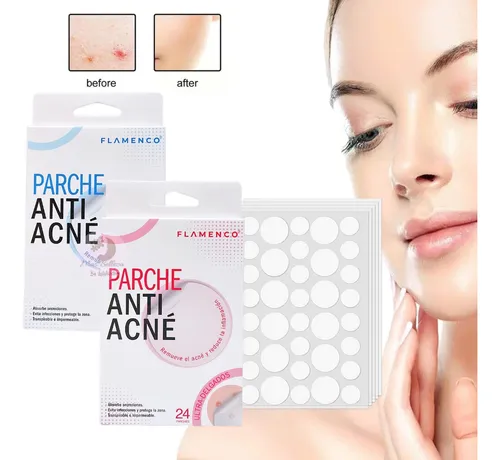 PARCHES ANTI-ACNE