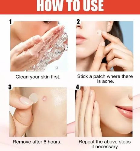 PARCHES ANTI-ACNE - Imagen 4