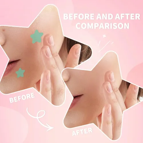 PARCHES ANTI-ACNE DE FIGURAS - Imagen 7